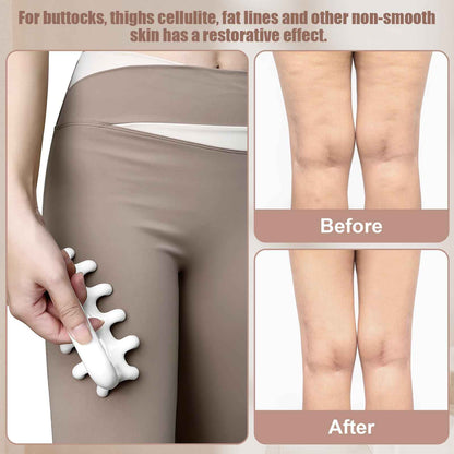 VEMOKY Fascia Massage Tool Trigger Point Massage Tools Anti Blaster for Cellulite Massager Tool Reaching Deep Myofascial Tissue Throughout The Body Release Muscle Knot Reduction Cellulite 🍁 All In One Marketplace Canada