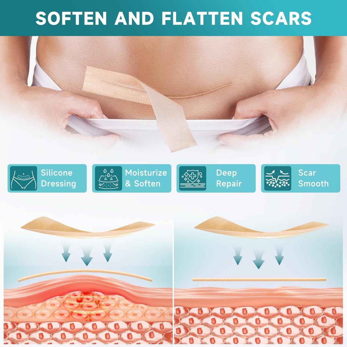 Pumkot Silicone Scar Sheets, Silicone Scar Tape(1.6” x 120” Roll-3M) 🍁 All In One Marketplace Canada