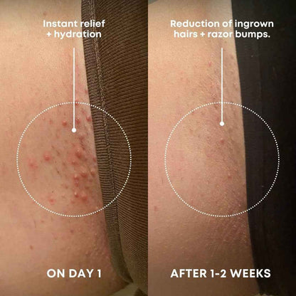 Bushbalm Ingrown Hair Exfoliating Scrub - Reduces Appearance of Ingrown Hairs and Razor Bumps, Soothes Skin and Post-Shave Redness - Nude, 236 ml 🍁 All In One Marketplace Canada
