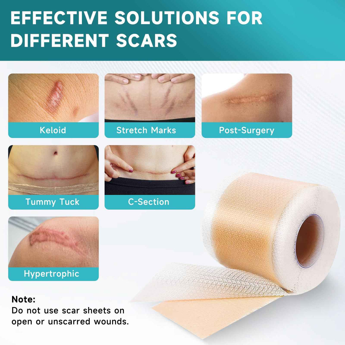 Pumkot Silicone Scar Sheets, Silicone Scar Tape(1.6” x 120” Roll-3M) 🍁 All In One Marketplace Canada