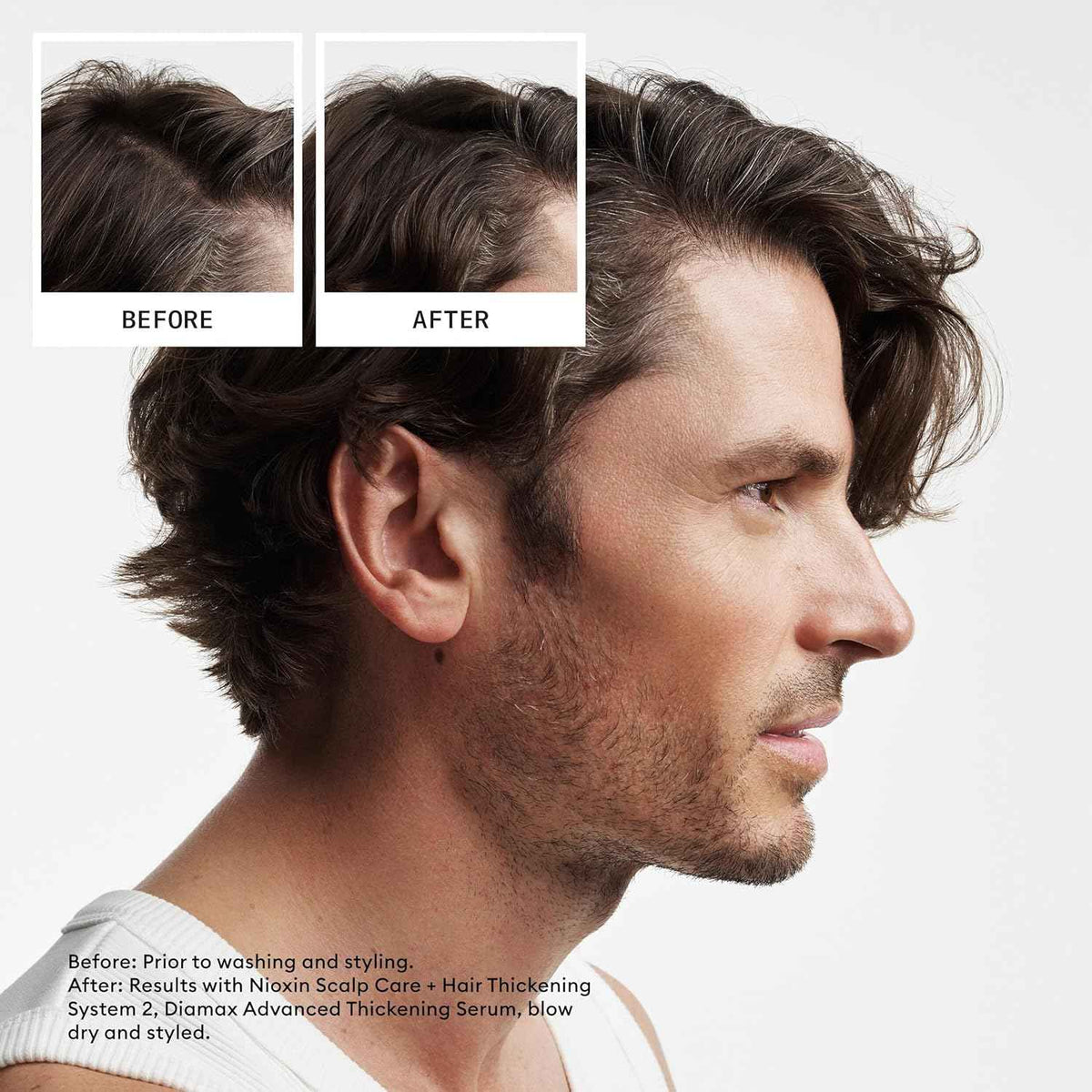Nioxin Scalp + Hair Thickening System 2 Shampoo, For Natural Hair with Progressed Thinning, 16.9 fl oz (Packaging May Vary) 🍁 All In One Marketplace Canada