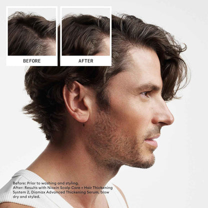 Nioxin Scalp + Hair Thickening System 2 Shampoo, For Natural Hair with Progressed Thinning, 16.9 fl oz (Packaging May Vary) 🍁 All In One Marketplace Canada