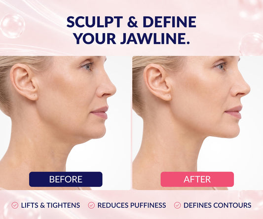 Stylia V Line Lifting Collagen Face Mask - Lift, Firm & Contour Jawline - Double Chin Strap with Hyaluronic Acid & Aloe Vera - Hydrating Neck & Face Tightening Mask - Chin Strap for Sleeping 10PC 🍁 All In One Marketplace Canada