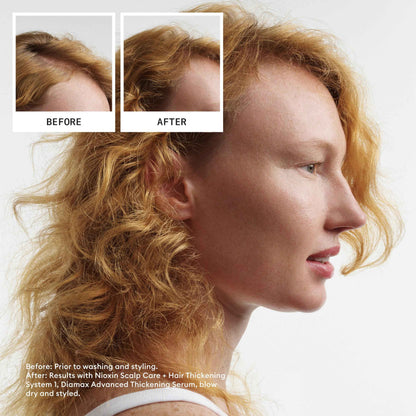 Nioxin System 4 Scalp + Hair Shampoo - Hair Thickening Shampoo For Damaged Hair with Progressed Thinning, 16.9 fl oz (Packaging May Vary) 🍁 All In One Marketplace Canada