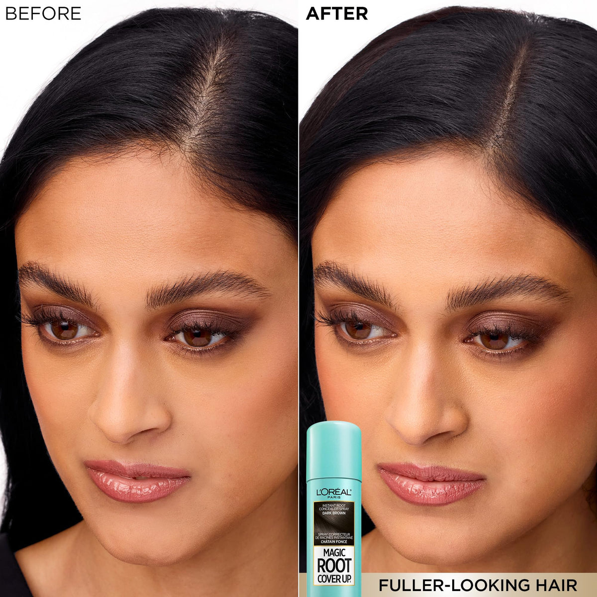 L'Oréal Paris Magic Root Cover Up Root Touch Up, Medium Brown Blonde Hair Dye, Root Touch Up Spray for Thinning Hair, Temporary Hair Dye, Grey Coverage, Pack of 2 🍁 All In One Marketplace Canada