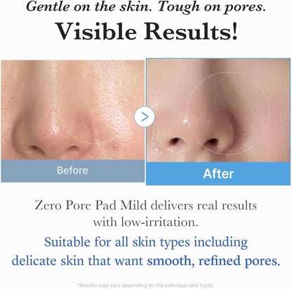 Medicube Zero Pore Pad 155g / 70 pads